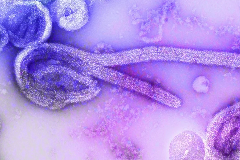 Vírus ebola. Metrópoles