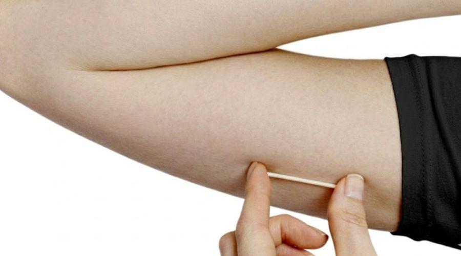 Implante contraceptivo Implanon é oferecido a mulheres em situação de rua em Vila Velha