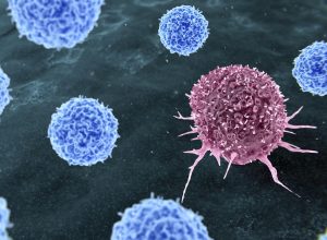 1 de 1 Ilustração representando a terapia com linfócitos infiltrantes de tumor (TIL) para o tr...