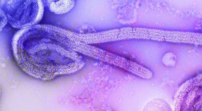 Vírus ebola. Metrópoles